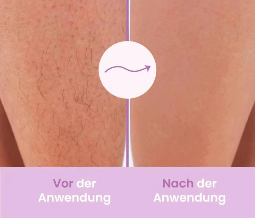 HydroSmooth | Der effektive Haarentferner