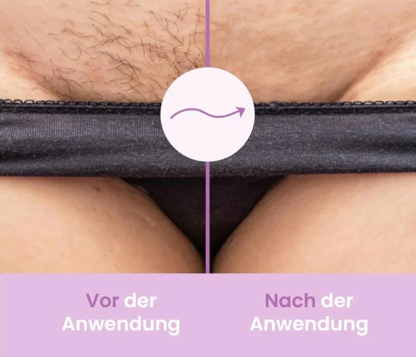 HydroSmooth | Der effektive Haarentferner